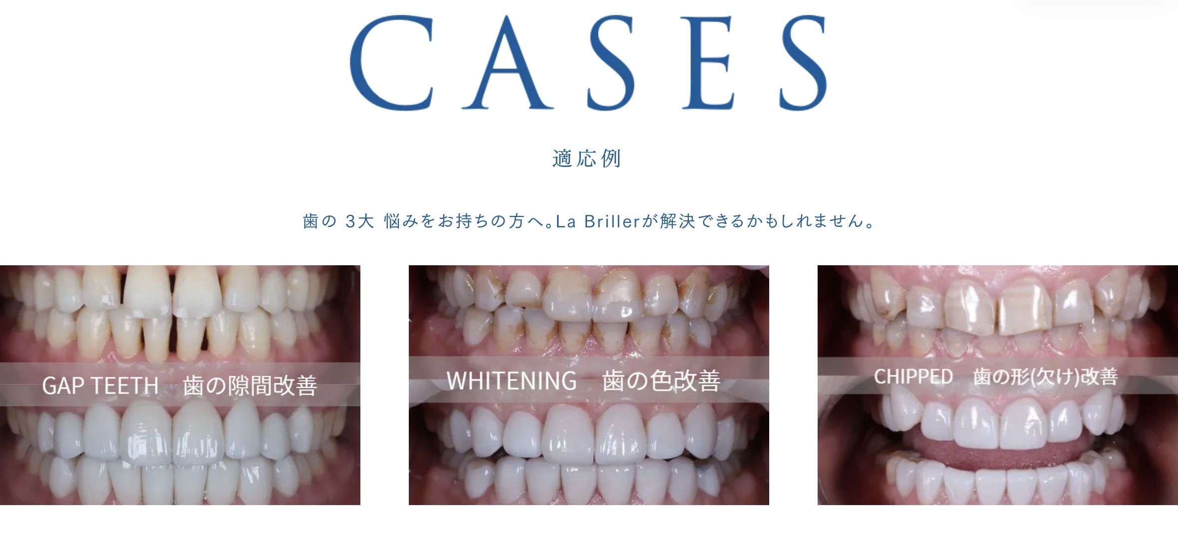 CASES 適応例 — 歯の3大悩みをお持ちの方へ。La Brillerが解決できるかもしれません。